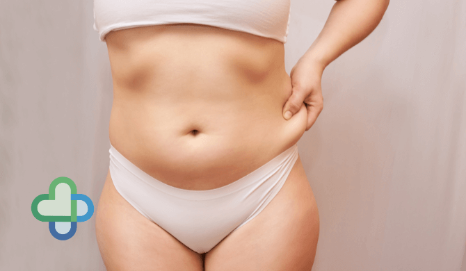 woman with belly fat pulling her skin - tips on how to lose weight - the family chemist